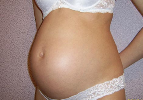 7 неделя беременности месячные
