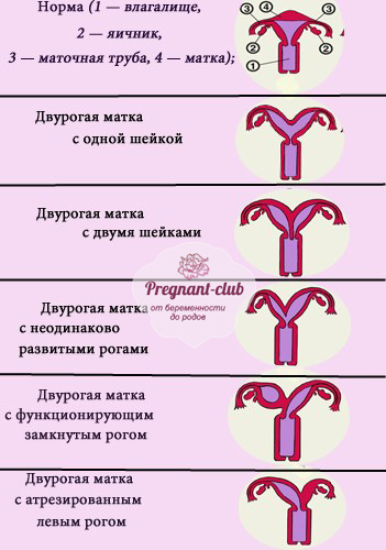 Патологии развития матки